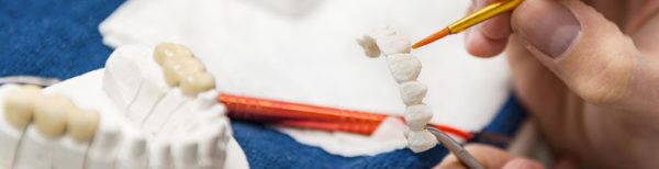 Fixed Archives - Ultimate Dental, Denture, Crown & Implants Lab